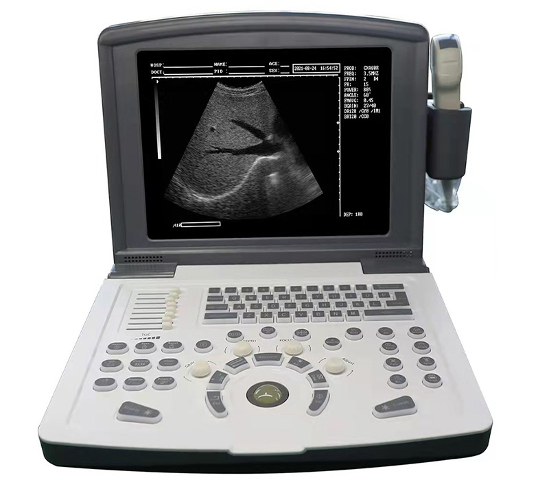 SM-3000A Portable B_W Ultrasound Machine