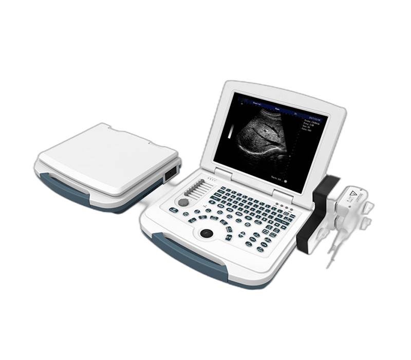 SM-90D Laptop Type BW Ultrasonic Diagnostic System