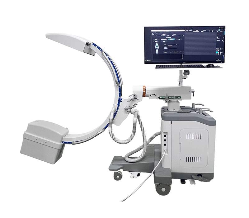 SMC-1500D Flat-panel Detector  Mobile C-arm X-ray Machine